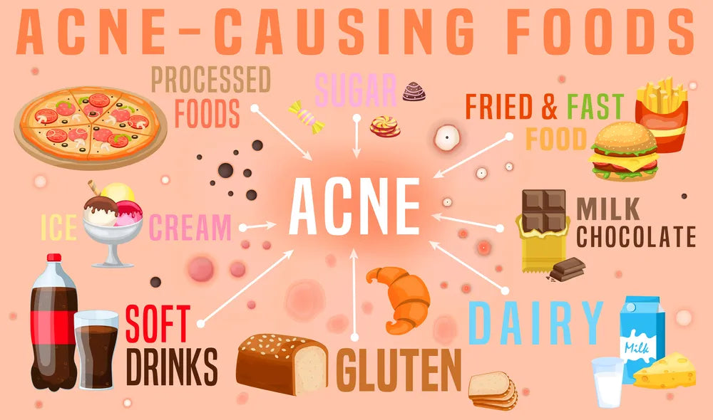 Diet for Acne Problem !